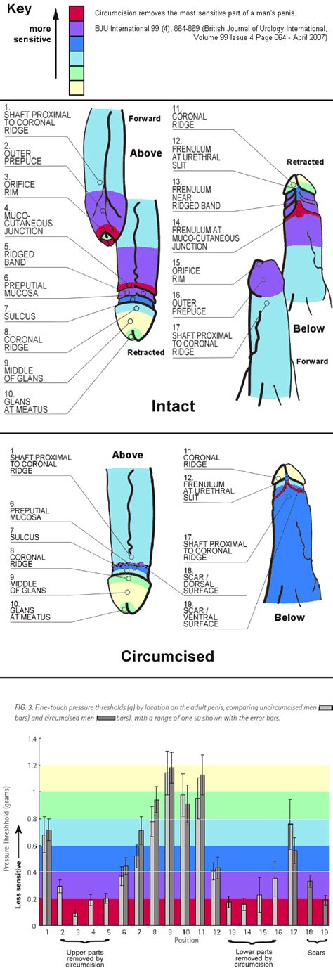 For many people, it is a choice. Low and tight circumcision. Circumcision - IntactiWikiAn ...