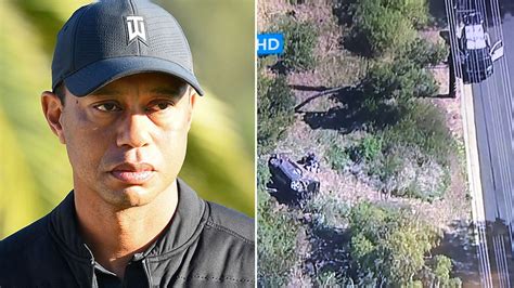 Photos Tiger Woods Hospitalized With Multiple Leg Injuries Undergoing Surgery Fox News