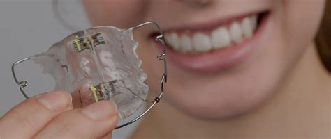 Removable Braces Orthodontic Sense
