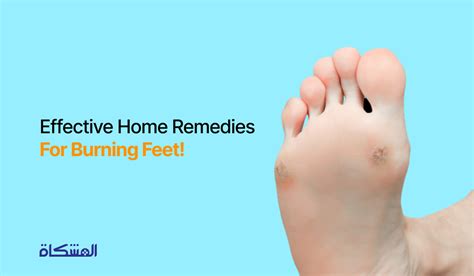 Effective Home Remedies For Burning Feet 2023