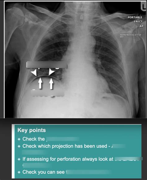 Abdominal X Ray System And Anatomy Diagram Quizlet