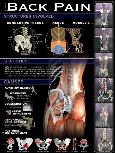 Low back pain is a fact of life. 20 Interesting Infographics On Back Pain - Infographics ...