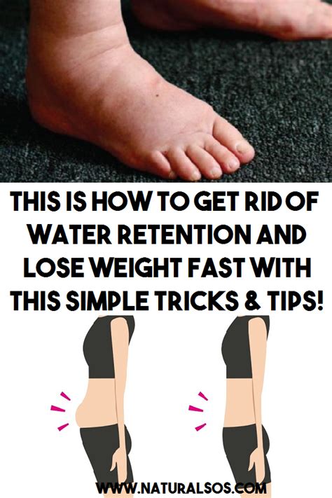 Pin On Water Retention Remedies