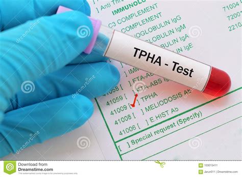 TPHA test stock image. Image of blood, laboratory, disease - 103015411