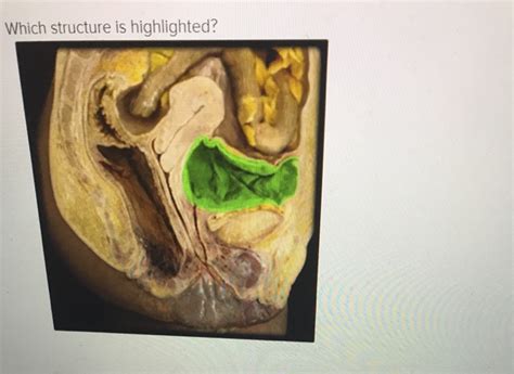 Solved Which Structure Is Highlighted O External Urethral Chegg Com