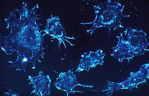 Cancer Treatment Everything You Need To Know About Immunotherapy