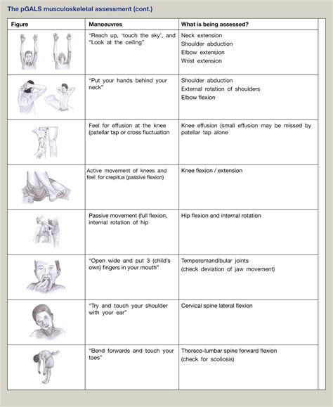 Check spelling or type a new query. Chronic arthritis in children and young people - Medicine