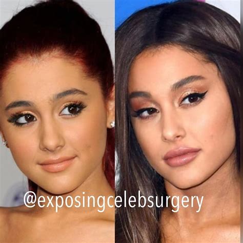 Why Celebrities Like Bella Hadid Ariana Grande And Kylie Jenner Are