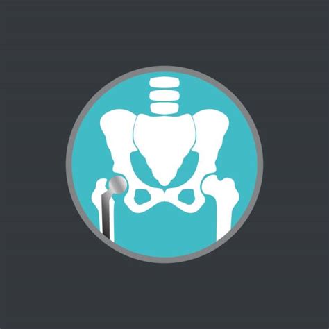 Royalty Free Hip Surgery Clip Art Vector Images And Illustrations Istock