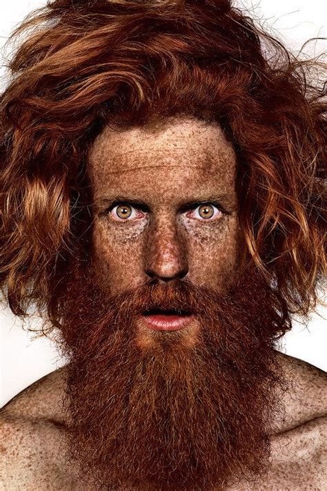 These Portraits Celebrate The Joy Of Having Freckles Portrait