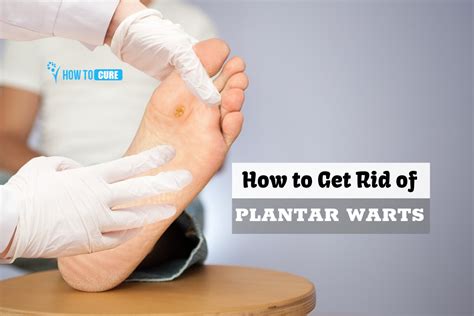 Five Natural Remedies On How To Get Rid Of Plantar Warts Effectively