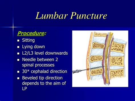 Ppt Lumbar Puncture Powerpoint Presentation Id3060338