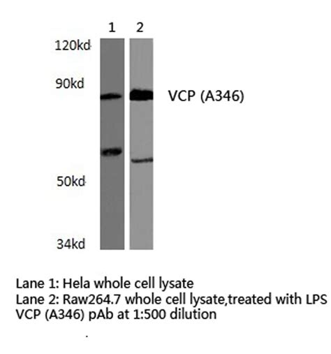 vcp antibody pa5 86653