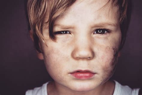 Signs A Child May Be Being Abused Huffpost Uk Parents
