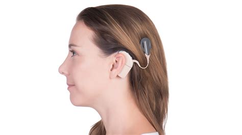 Cochlear Implants Aopa