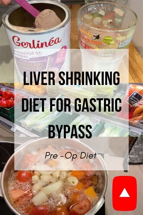 Liver Shrinking Diet For Gastric Bypass Surgery In 2022 Liver