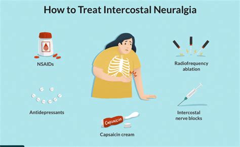 Neuritis Intercostal Definicion Causas Sintomas Tratamiento Y