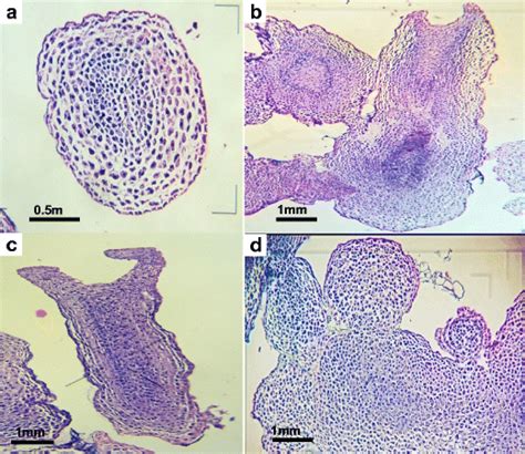 Histology Of Somatic Embryos Showing Different Stages A Post Globular