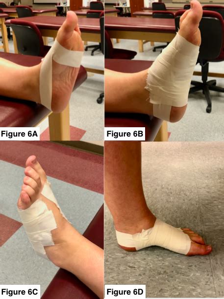 Forefoot Injuries In Athletes Integration Of The Movement System