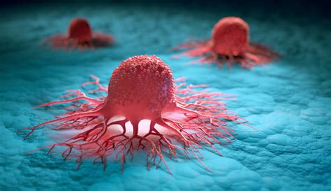 Tumors 이미지 찾아보기 74439 스톡 사진 벡터 및 비디오 Adobe Stock
