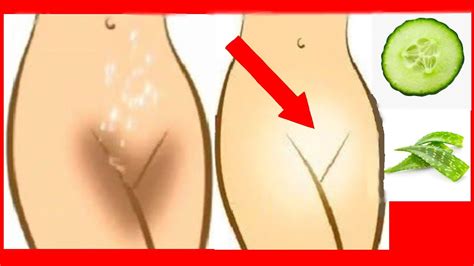 Whiten Private Areas How To Make Natural Home Remedy Anal Bleaching