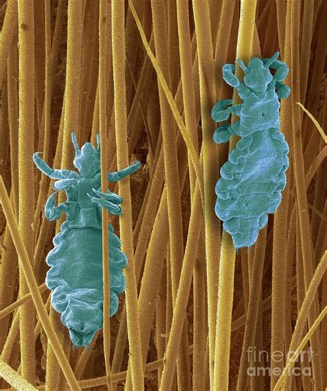 Head Lice Photograph By Steve Gschmeissnerscience Photo Library Pixels