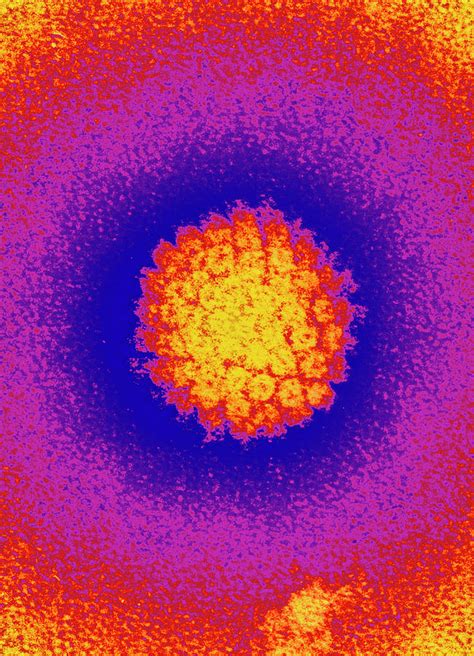 Herpes Virus Particle Photograph By Nciscience Photo Library Fine