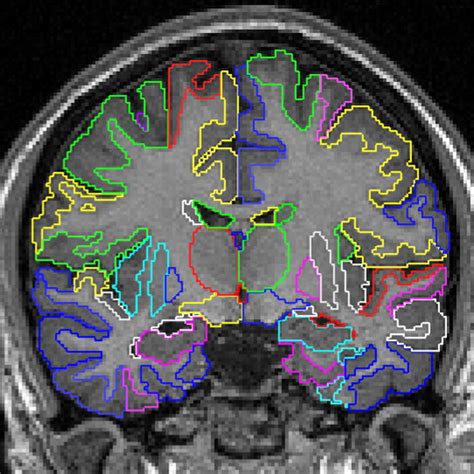 Papers With Code Medical Image Segmentation