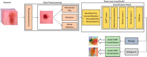 Sensors Free Full Text Classification Of Skin Cancer Lesions Using Explainable Deep Learning