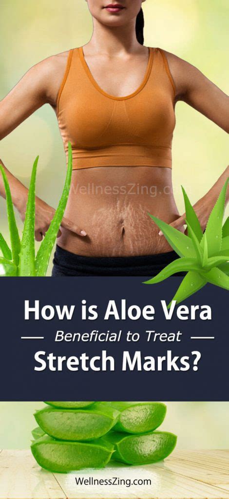 How To Remove Strech Marks On Skin With Aloe Vera