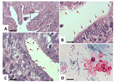 This background document aims to give guidance on a system assessment for cryptosporidium, one of the microbial hazards for. Light microscopy of Cryptosporidium. (A-C) Histological sections of... | Download Scientific Diagram