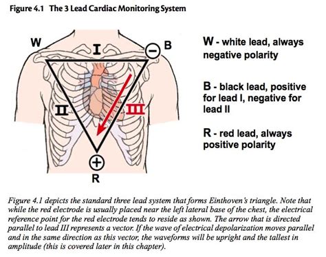 Einthovens Triangle Correlates To 3 Lead Cardiac