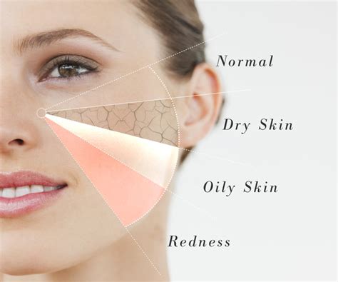 Check Your Skin Type Yourself Tips For Healthier Lifestyle