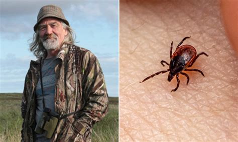 Now Tick Bites Spark A Deadly Meat Allergy And Even The Smell Of
