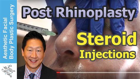 Live Demo Post Rhinoplasty Steroid Kenalog Injections For Swelling