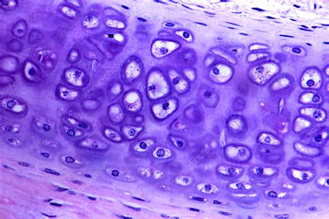 Hyaline Cartilage Stock Image P Science Photo Library