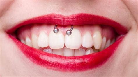Inconvenientes De Los Piercing En La Boca Clínica Dental Astigarraga