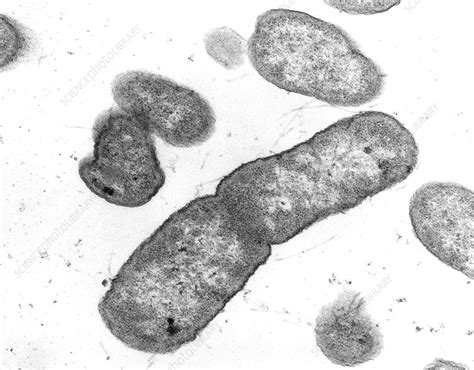 Volker brinkmann, max plank institute for infection biology, berlin. Salmonella typhimurium bacteria - Stock Image - B220/0307 ...