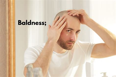 How To Cure Baldness With The Help Of Natural Remedies Health Nigeria