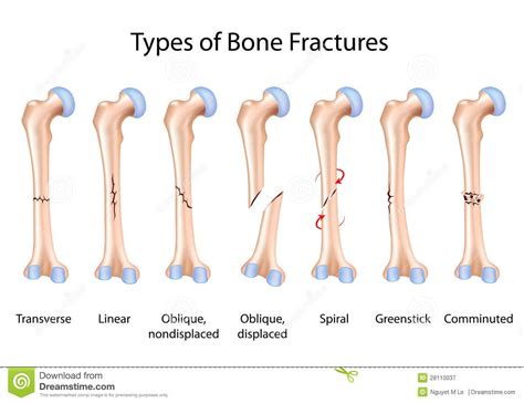 Physical Therapy Asistant (pta) Pta230 > R. Paras ...
