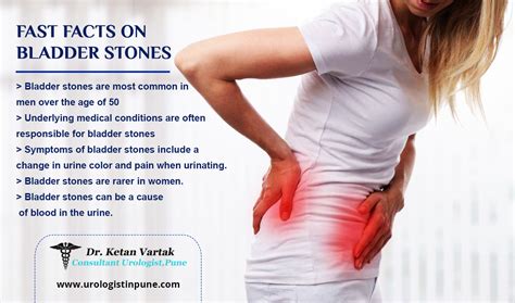 What Is Bladder Stone And Its Symptoms Dr Ketan Vartak