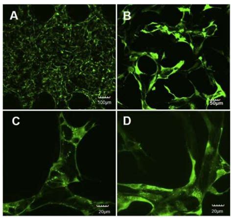 Neuromics Human Brain Microvascular Endothelial Cells Hbmecs My