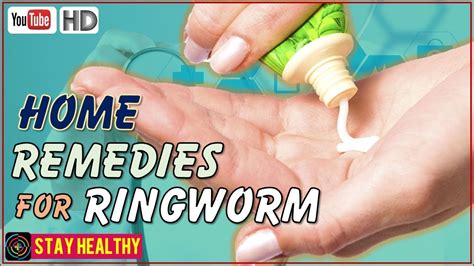 9 Home Remedies For Ringworm In Humans Youtube