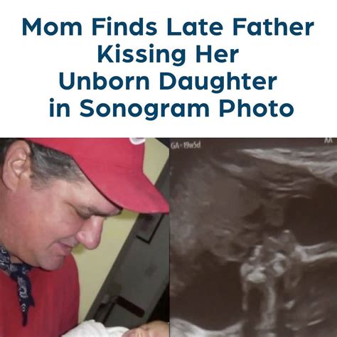 Mom Finds Late Father Kissing Her Unborn Daughter In Sonogram Photo