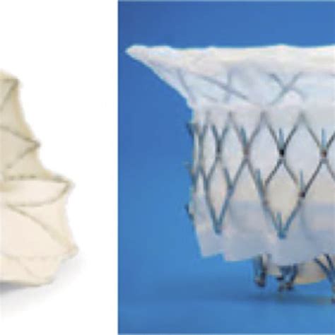 Transcatheter Heart Valves Used For The Treatment Of Mitral Valve