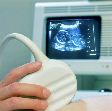 Ultrasound Scanning Of A Pregnant Woman Photograph By Saturn Stillsscience Photo Library Pixels
