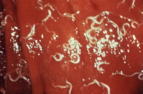 What they are, and why you should know. Trichuris trichiura | Medical Laboratories