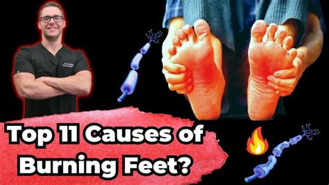 Top 11 Causes And Treatments Of Burning Feet