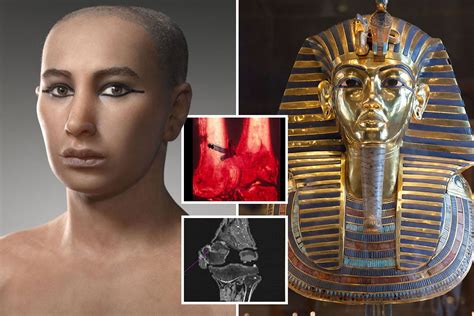 mystery of tutankhamun s death solved as academic claims infection after leg fracture killed