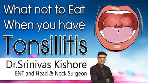 Hi9 What Not To Eat When You Have Tonsillitis Dr Srinivas Kishore